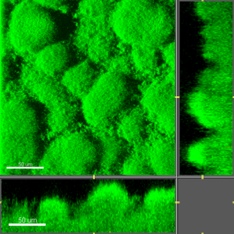 microscopic biofilm