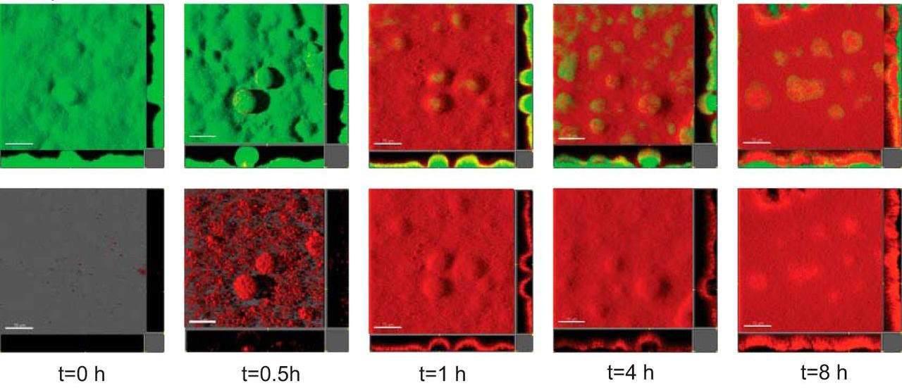 microscopic biofilm